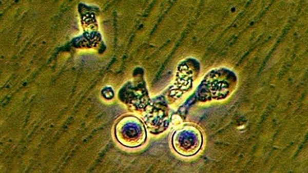 韓國報(bào)告首例“食腦蟲”病例：一天即死亡、不會(huì)人傳人